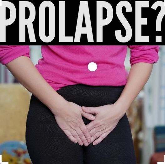 Prolapse Uterus