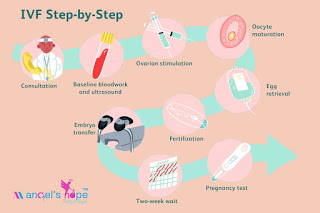 In Vitro Fertilization or IVF