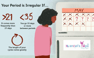 Irregular periods